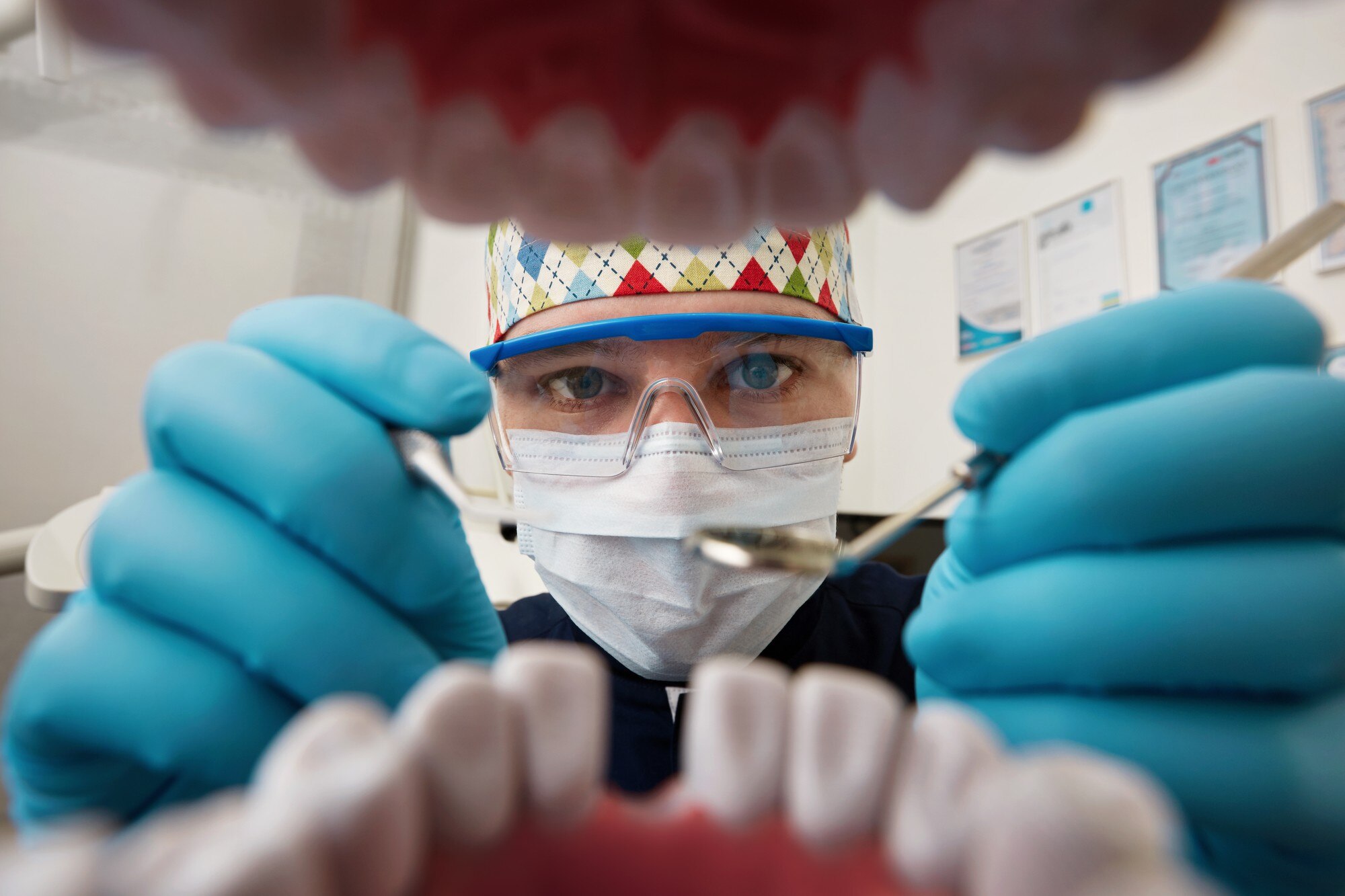 Dental implants vs bridges – which choice is best?